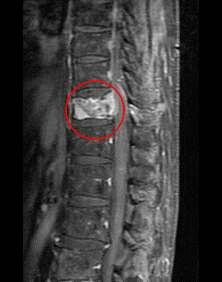 １．術前MRI1（差替え）.jpg