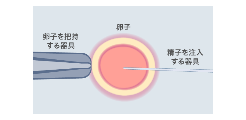 figure-c2.png