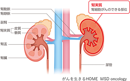 腎臓の病気