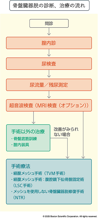 骨盤臓器脱の診断、治療の流れ