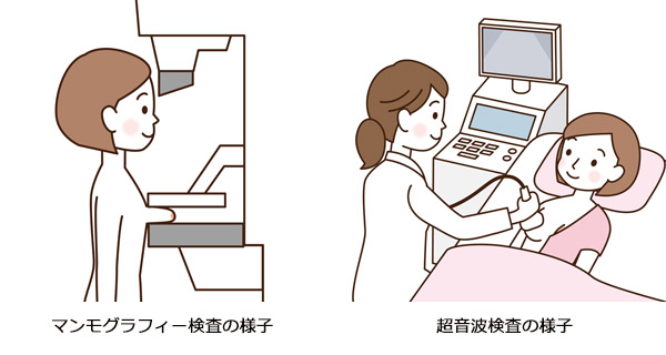 図：検査