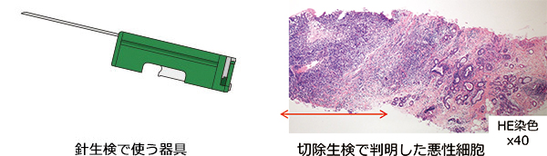 図：検査