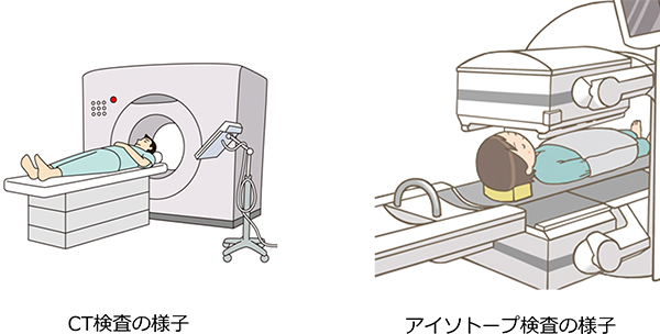 図：検査