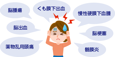 図：頭痛の種類