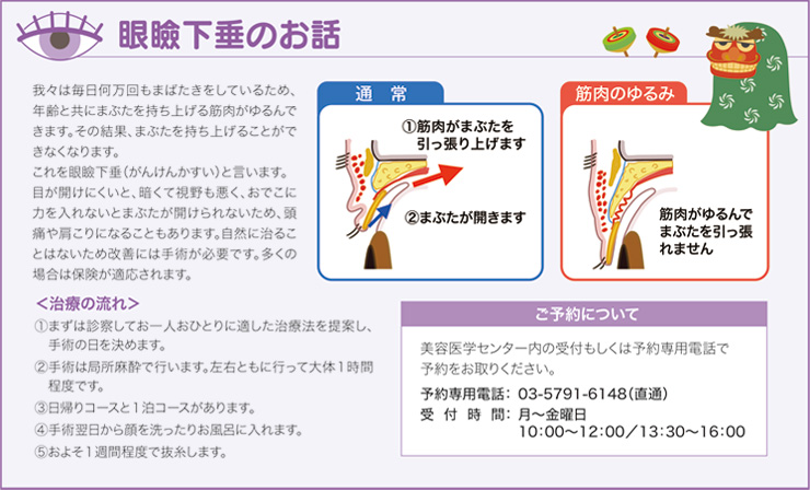 眼瞼下垂のお話